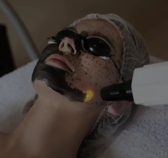 hydrafacial carboxy pic_2