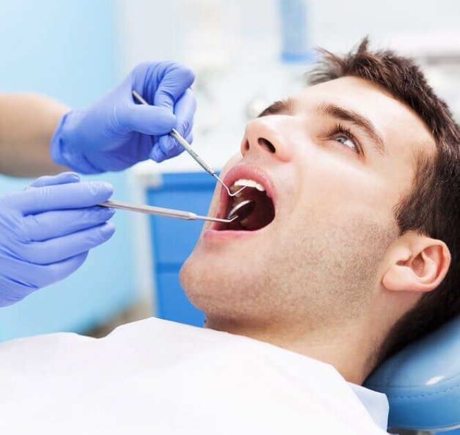 Fluoride Therapy_Pic (1)