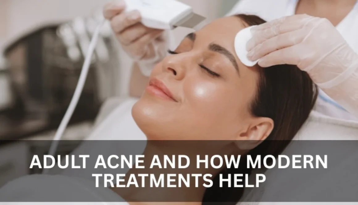 Acne Treatment in Al Nahda Dubai