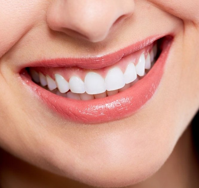 Smile Makeover_Pic (2)