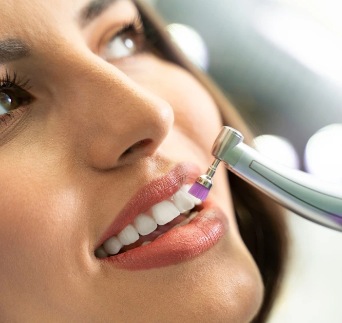 teeth polishing in al nahda dubai