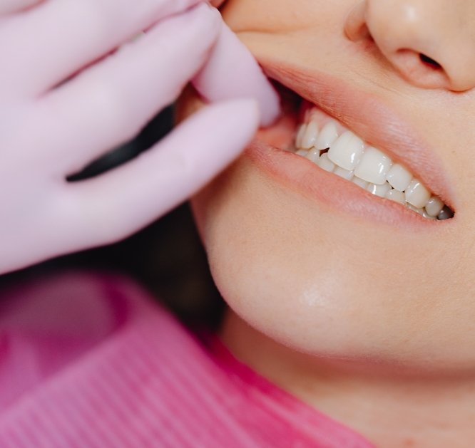 Teeth Extraction pic (1)