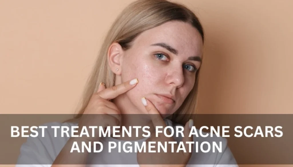pigmentation treatment in Al Nahda