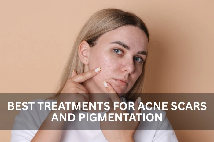 pigmentation treatment in Al Nahda