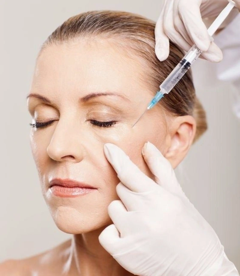 Crow’s feet botox_results_img