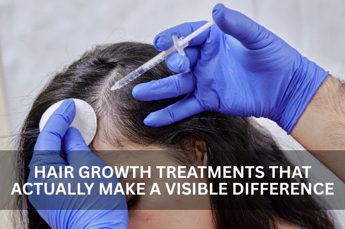 prp treatment in dubai