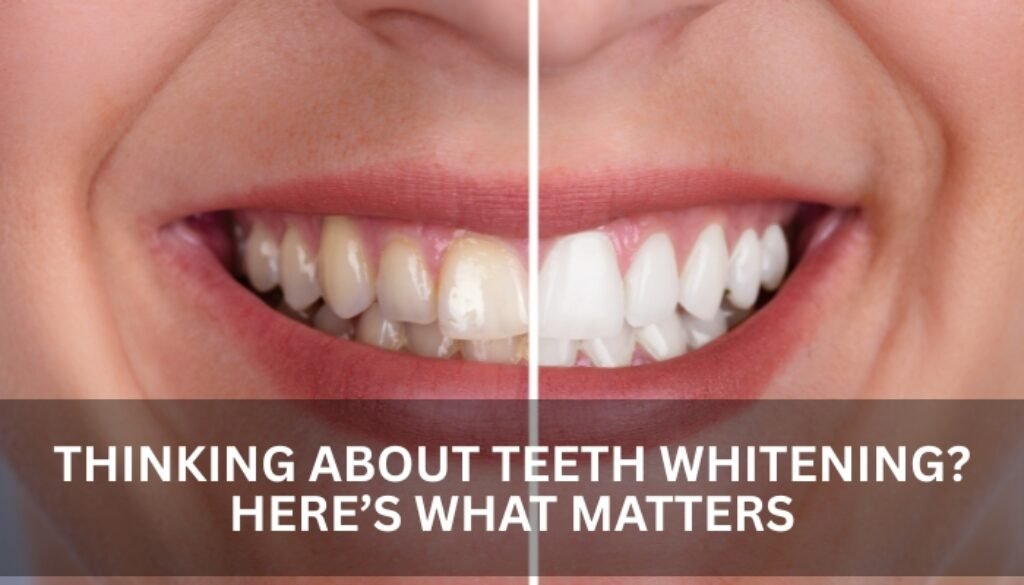 teeth whitening in dubai