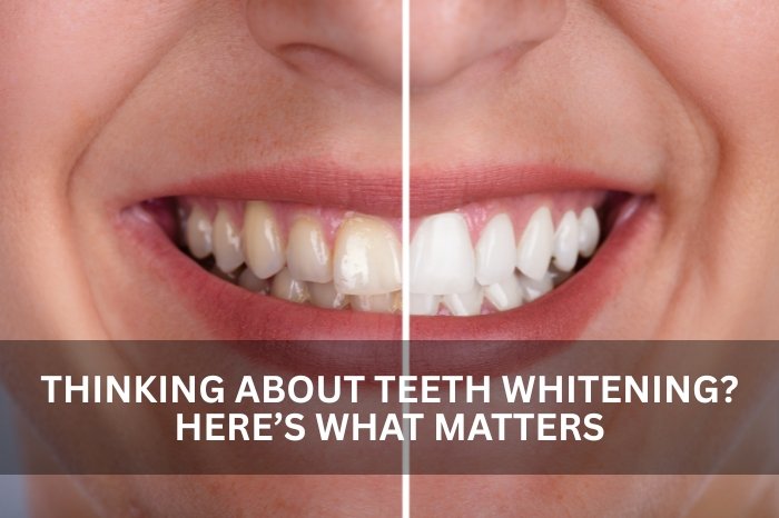 teeth whitening in dubai